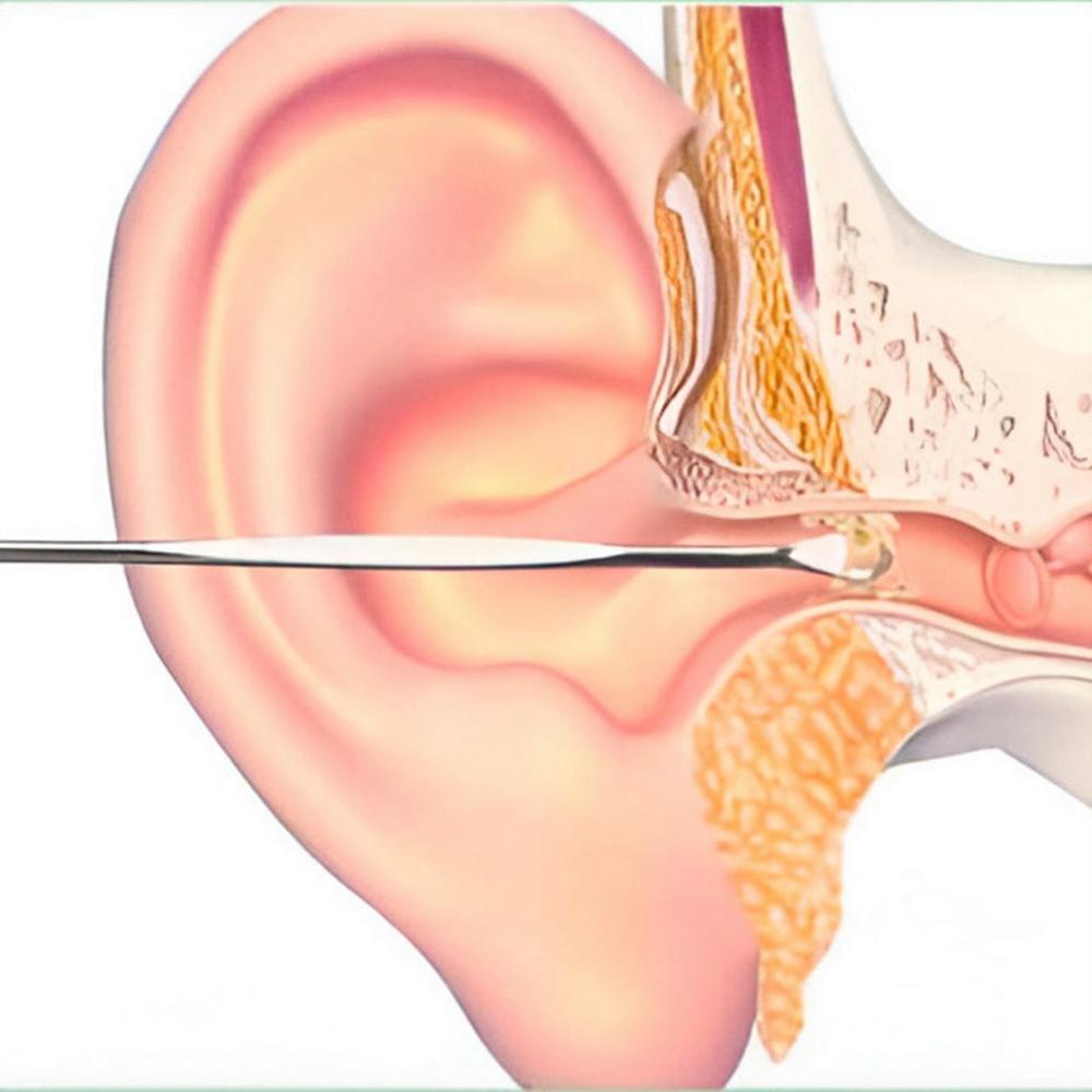 Set Kit Limpieza Higiene Cera Oídos Orejas Reutilizable img #3