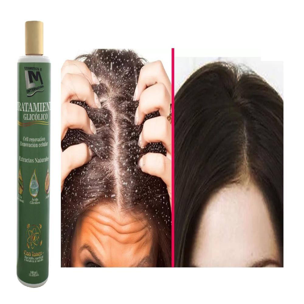 Tratamiento Glicólico Peeling Capilar Lm X 340Ml. img #2