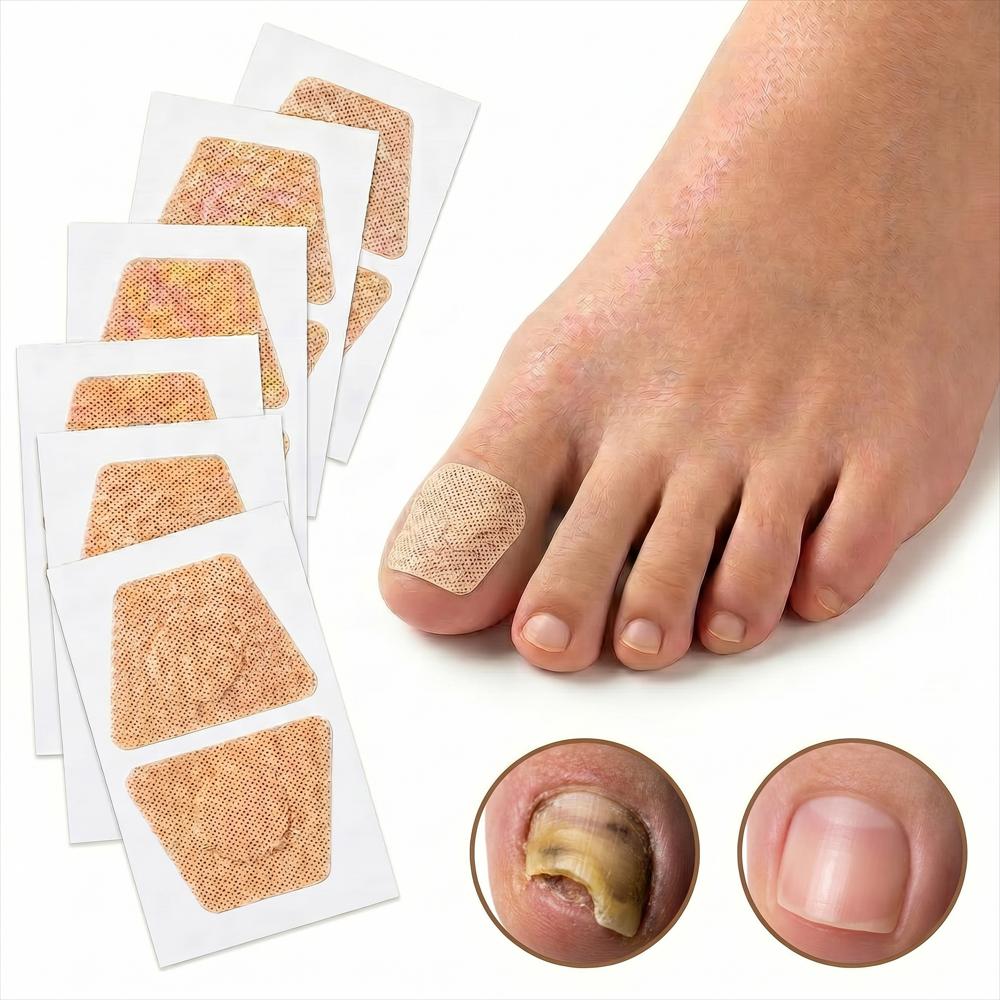 Parches Natural Correctores Uñas Encarnadas Hongos Pie 10Und img #1