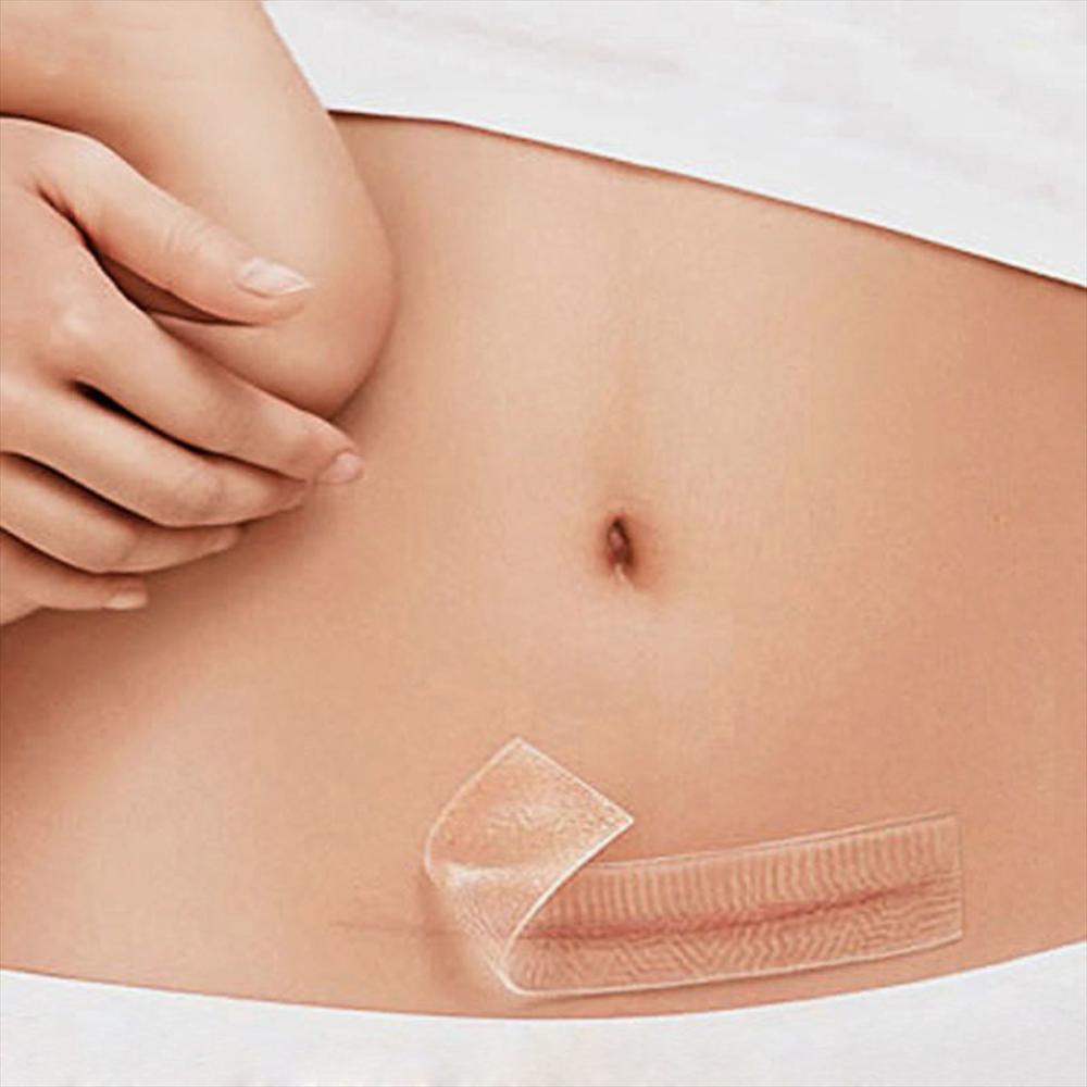 Cinta Silicona Para Cicatrices Parches Reutilizables Impermeables Gel Medico img #2